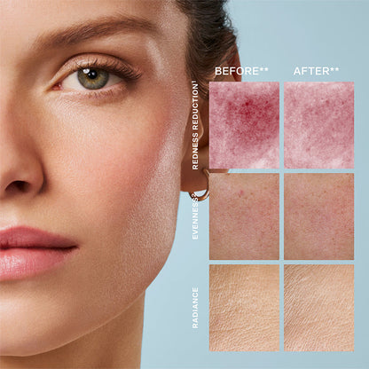 SERUM